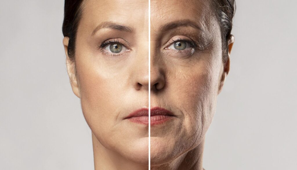 Eye bag treatment at Dr. Ujjwala's Skin Clinic - Say Goodbye to Puffiness and Dark Circles 1 Before-and-after portrait of a middle-aged woman showing natural skin aging on the right and smoother, retouched skin on the left.